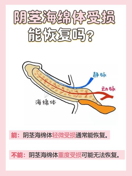 3D打印仿生阴茎海绵体问世！未来能否彻底解决男性功能障碍？  第5张