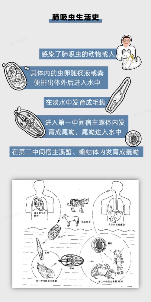 你还敢吃生腌美食吗？10岁男童因生吃蟹腿感染肺吸虫，惊悚真相曝光  第2张