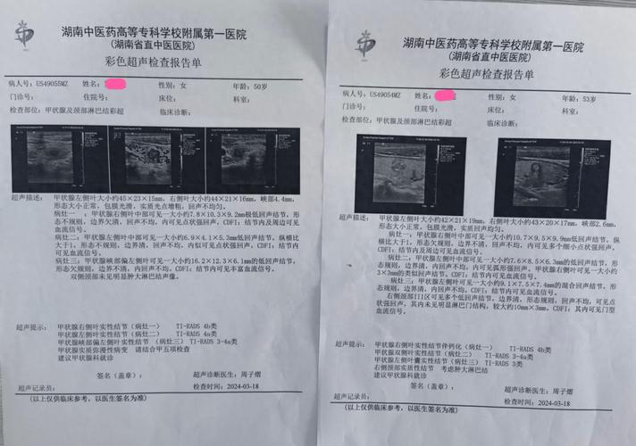 家族中一人患甲状腺癌，竟牵连全家！你还在忽视体检吗？  第3张