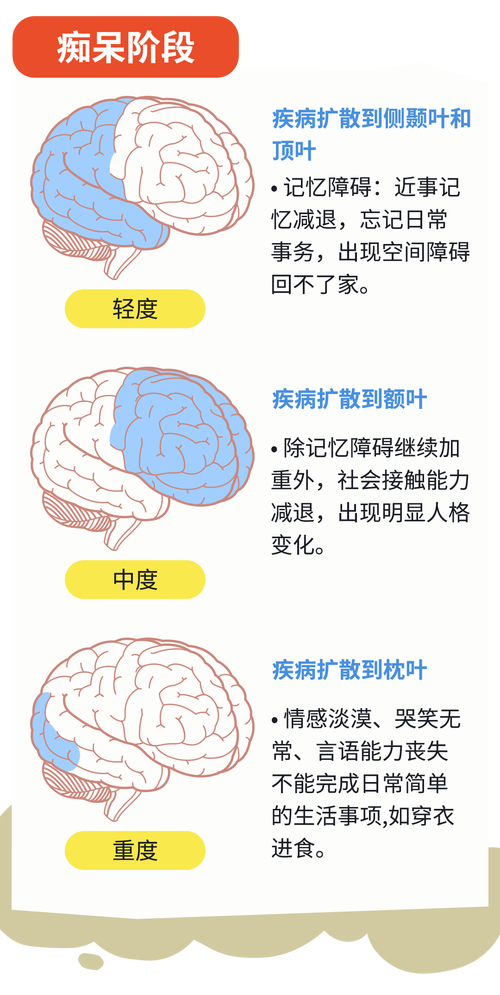 阿尔茨海默病竟然可以通过手术治疗？西安交大医院手术成功案例震惊医学界  第11张