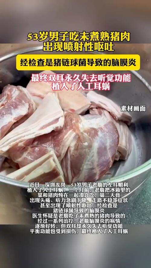 惊悚！男子因食用未煮熟猪肉，体内竟遍布虫卵？医生警告：后果不堪设想  第3张