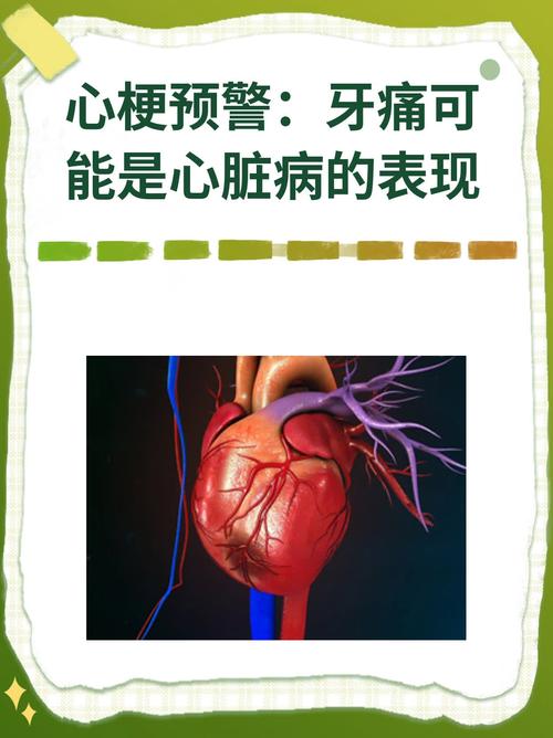 心梗前兆竟被忽视？牙疼、腹痛可能是致命信号！你留意了吗？  第3张