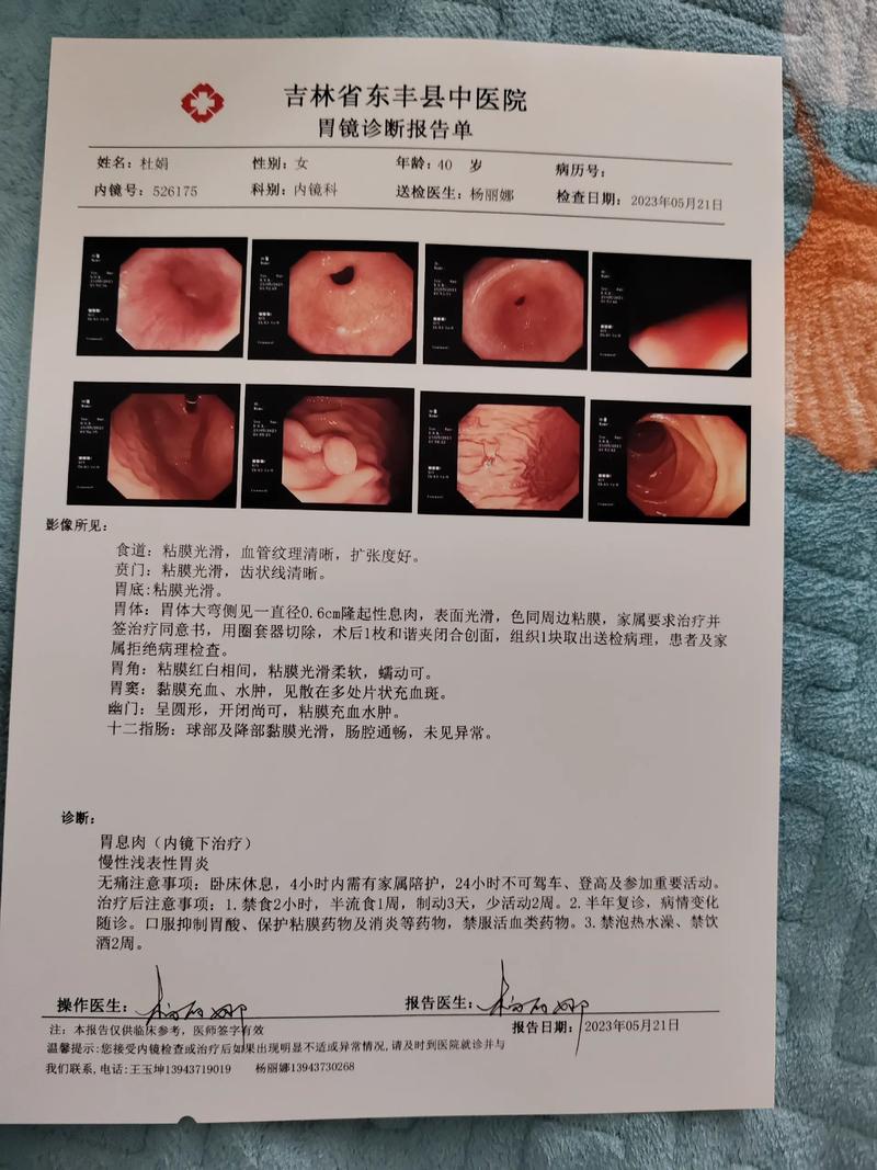 体检报告上的息肉究竟要不要紧？这种肠息肉几乎100%会癌变  第7张